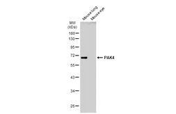 Anti-PAK4 antibody [C1C3] used in Western Blot (WB). GTX107787