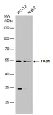 Anti-TAB1 antibody used in Western Blot (WB). GTX107892