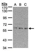 Anti-EPM2AIP1 antibody [N1], N-term used in Western Blot (WB). GTX107983
