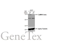 Anti-CaMKK beta antibody used in Western Blot (WB). GTX108305