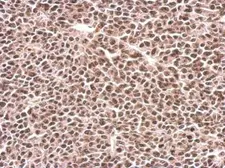 Anti-PFKFB3 antibody [C3], C-term used in IHC (Paraffin sections) (IHC-P). GTX108335