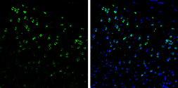 Anti-Syntenin 1 antibody [C2C3], C-term used in IHC (Frozen sections) (IHC-Fr). GTX108470