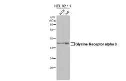 Anti-Glycine Receptor alpha 3 antibody used in Western Blot (WB). GTX108513