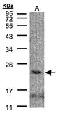 Anti-CMTM3 antibody [C1C3] used in Western Blot (WB). GTX108549