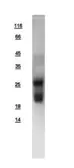 Human RHOB protein, His tag. GTX108600-pro