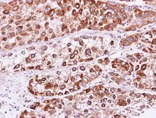 Anti-RAB2B antibody used in IHC (Paraffin sections) (IHC-P). GTX108606