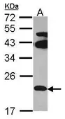 Anti-FAM18B antibody [N2C2], Internal used in Western Blot (WB). GTX108658