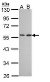 Anti-DPP2 antibody [N3C3-2] used in Western Blot (WB). GTX108734