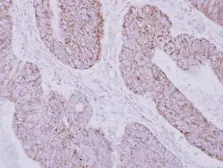 Anti-PSTPIP2 antibody used in IHC (Paraffin sections) (IHC-P). GTX108886