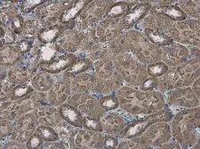 Anti-SLC25A13 antibody [N3C2], Internal used in IHC (Paraffin sections) (IHC-P). GTX109001