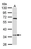 Anti-HSD17B6 antibody [N1C3] used in Western Blot (WB). GTX109009