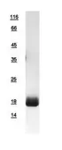 Human Calcineurin B protein, His tag. GTX109127-pro