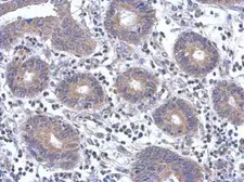 Anti-FYN antibody [N1C2] used in IHC (Paraffin sections) (IHC-P). GTX109428