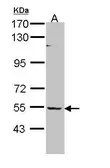 Anti-BAIAP2L1 antibody [N1C1] used in Western Blot (WB). GTX109453