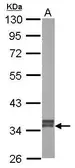 Anti-GRHPR antibody [N1C3] used in Western Blot (WB). GTX109575