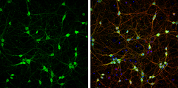 Anti-PGP9.5 antibody used in Immunocytochemistry/ Immunofluorescence (ICC/IF). GTX109637