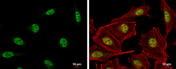 Anti-DNA-PKcs antibody [C3], C-term used in Immunocytochemistry/ Immunofluorescence (ICC/IF). GTX109673