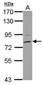 Anti-HCS antibody used in Western Blot (WB). GTX109815
