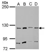 Anti-Myosin 1A antibody [N2C1], Internal used in Western Blot (WB). GTX110081