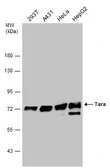 Anti-Tara antibody [C2C3-2], C-term used in Western Blot (WB). GTX110158