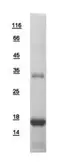Human PTS protein, His tag. GTX110549-pro
