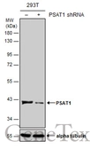 Anti-PSAT1 antibody [N1C3] used in Western Blot (WB). GTX110576