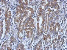 Anti-UBE4A antibody [N3C2], Internal used in IHC (Paraffin sections) (IHC-P). GTX110889