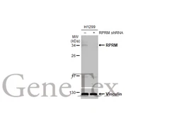 Anti-RPRM antibody [N1C3] used in Western Blot (WB). GTX110976