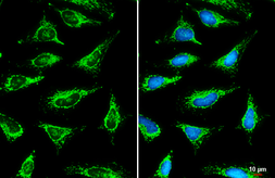Anti-SLC25A6 antibody used in Immunocytochemistry/ Immunofluorescence (ICC/IF). GTX110983