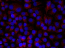 Anti-Paxillin antibody [PXC-10] used in Immunocytochemistry/ Immunofluorescence (ICC/IF). GTX11101