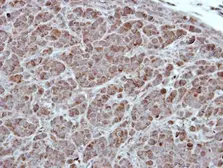 Anti-PKC alpha antibody [C1C3] used in IHC (Paraffin sections) (IHC-P). GTX111096