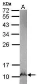 Anti-NDUFB3 antibody used in Western Blot (WB). GTX111211
