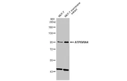 Anti-ATP6V0A4 antibody [N1N3-2] used in Western Blot (WB). GTX111243