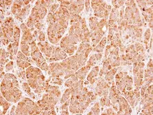 Anti-UNC13B antibody [N2N3] used in IHC (Paraffin sections) (IHC-P). GTX111244