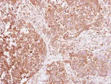 Anti-Insulin Receptor beta antibody used in IHC (Paraffin sections) (IHC-P). GTX111314