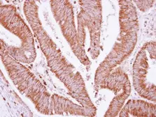 Anti-BCKDHA antibody [C1C3] used in IHC (Paraffin sections) (IHC-P). GTX111382