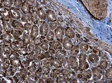 Anti-Hexokinase II antibody used in IHC (Paraffin sections) (IHC-P). GTX111525