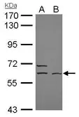 Anti-ELP3 antibody [N3C3] used in Western Blot (WB). GTX111912
