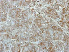 Anti-TEX14 antibody [N1N2], N-term used in IHC (Paraffin sections) (IHC-P). GTX111965