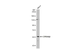 Anti-CYP21A2 antibody [N2C3] used in Western Blot (WB). GTX112135
