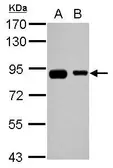 Anti-EPS8L2 antibody used in Western Blot (WB). GTX112158