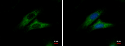 Anti-CTNNAL1 antibody [N3C2], Internal used in Immunocytochemistry/ Immunofluorescence (ICC/IF). GTX112226