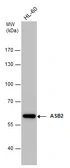 Anti-ASB2 antibody [N3C2], Internal used in Western Blot (WB). GTX112289