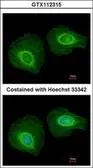 Anti-Cytokeratin 34 antibody [N1C2] used in Immunocytochemistry/ Immunofluorescence (ICC/IF). GTX112315