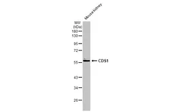 Anti-CDS1 antibody [C1C3] used in Western Blot (WB). GTX112491