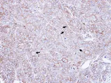 Anti-CAP1 antibody [C1C3] used in IHC (Paraffin sections) (IHC-P). GTX112578