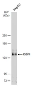 Anti-IGSF1 antibody [C1C2], Internal used in Western Blot (WB). GTX112633