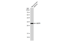 Anti-UCP1 antibody used in Western Blot (WB). GTX112784