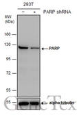 Anti-PARP antibody [N2C1], Internal used in Western Blot (WB). GTX112864