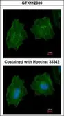 Anti-Filamin A antibody [C2], C-term used in Immunocytochemistry/ Immunofluorescence (ICC/IF). GTX112939